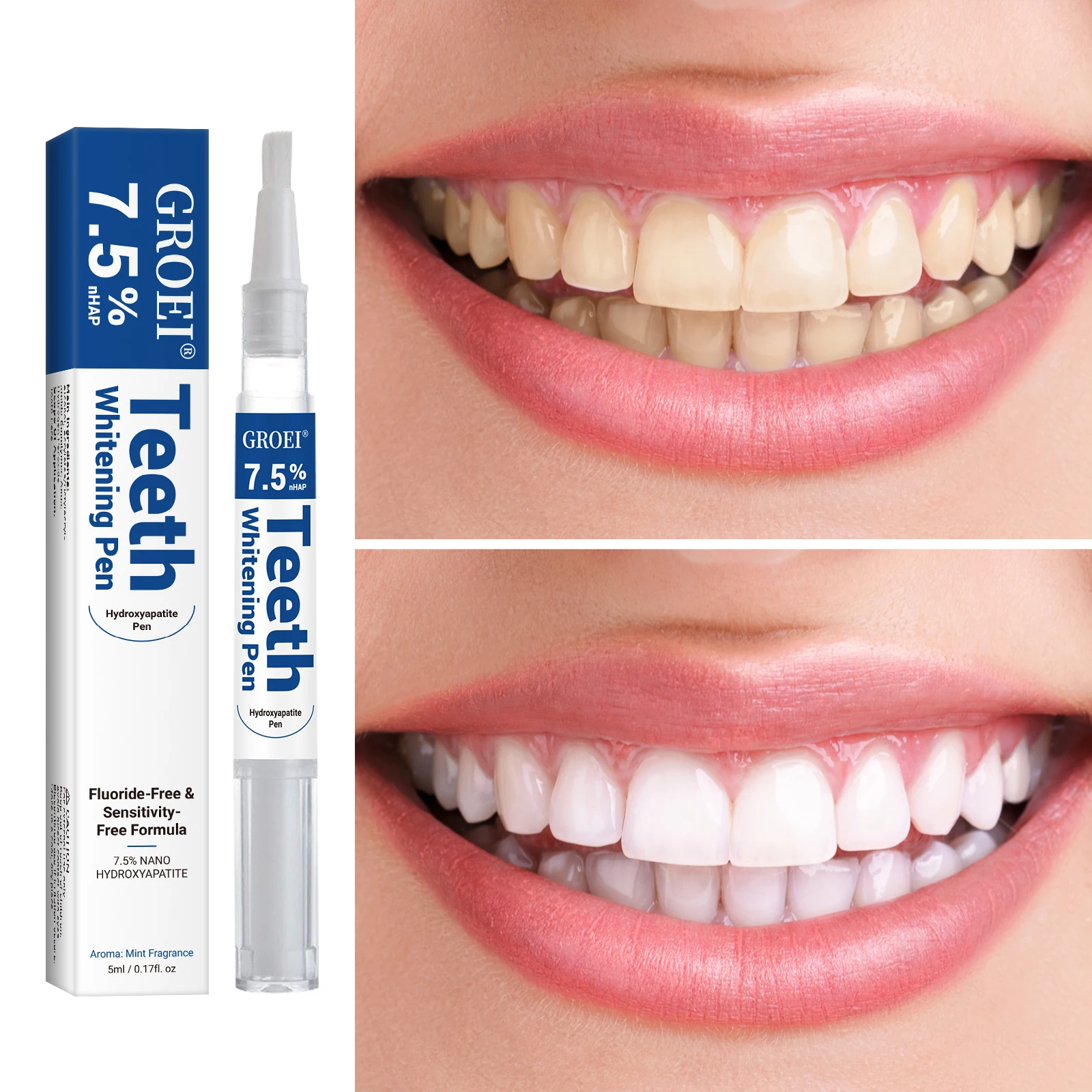 Hydroxyapatite Tooth Whitening - огляд і ціна Teeth Whitening Price