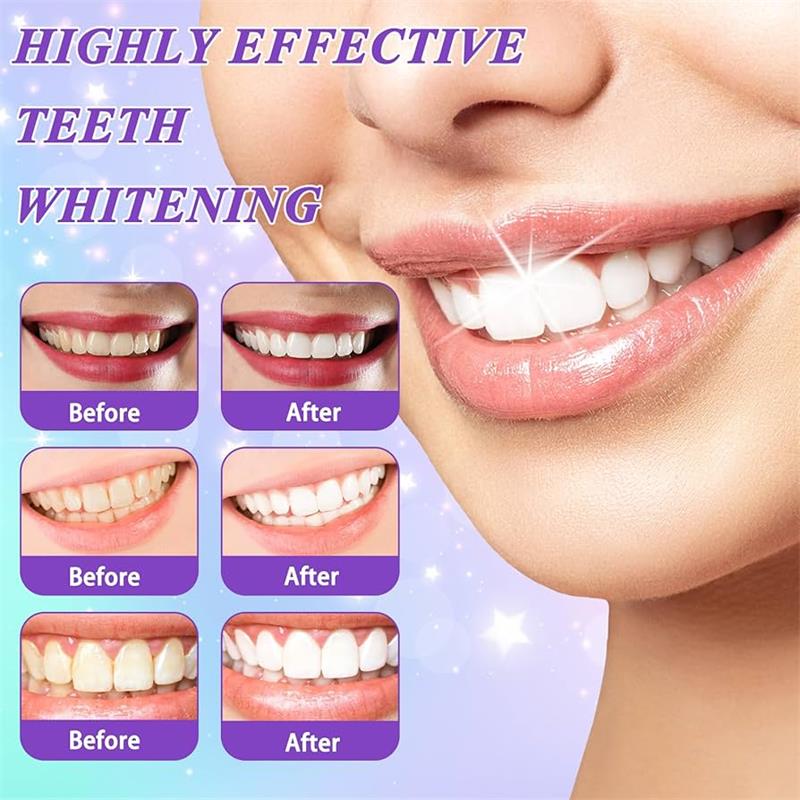 9D Purple Teeth Whitening Toot - огляд і ціна Teeth Whitening Toothpaste