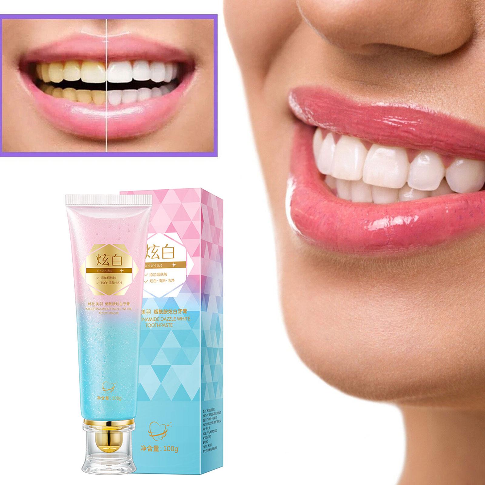 Niacinamide Whitening Toothpas - огляд і ціна Teeth Whitening Toothpaste