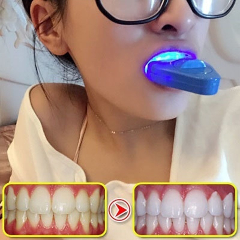 LED Teeth Whitening Light Whit - огляд і ціна Teeth Whitening Video