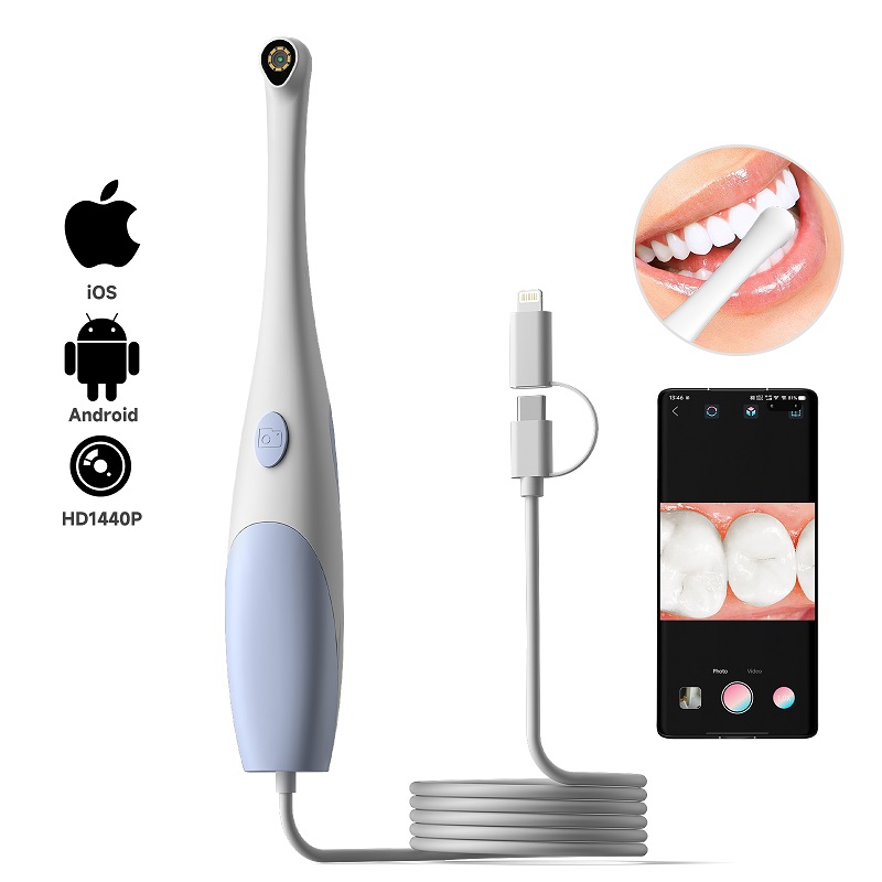 Oral Endoscope Camera 1440P Ph - огляд і ціна Teeth Whitening Video