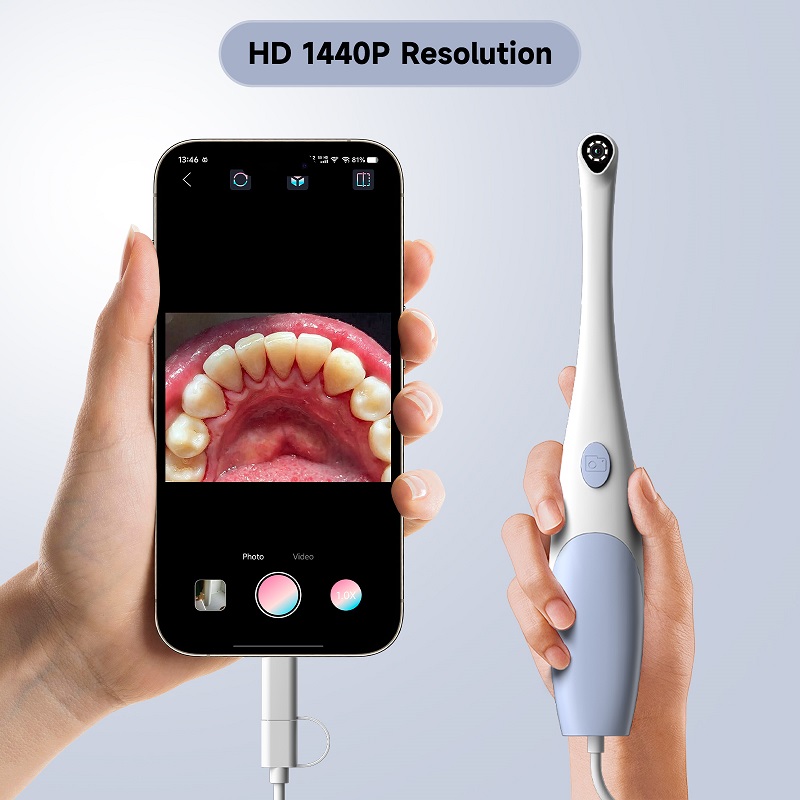 Oral Endoscope Camera 1440P Ph - огляд і ціна Teeth Whitening Video