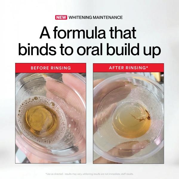 Hismile ID Whitening Stain Mou - огляд і ціна Teeth Whitening Products