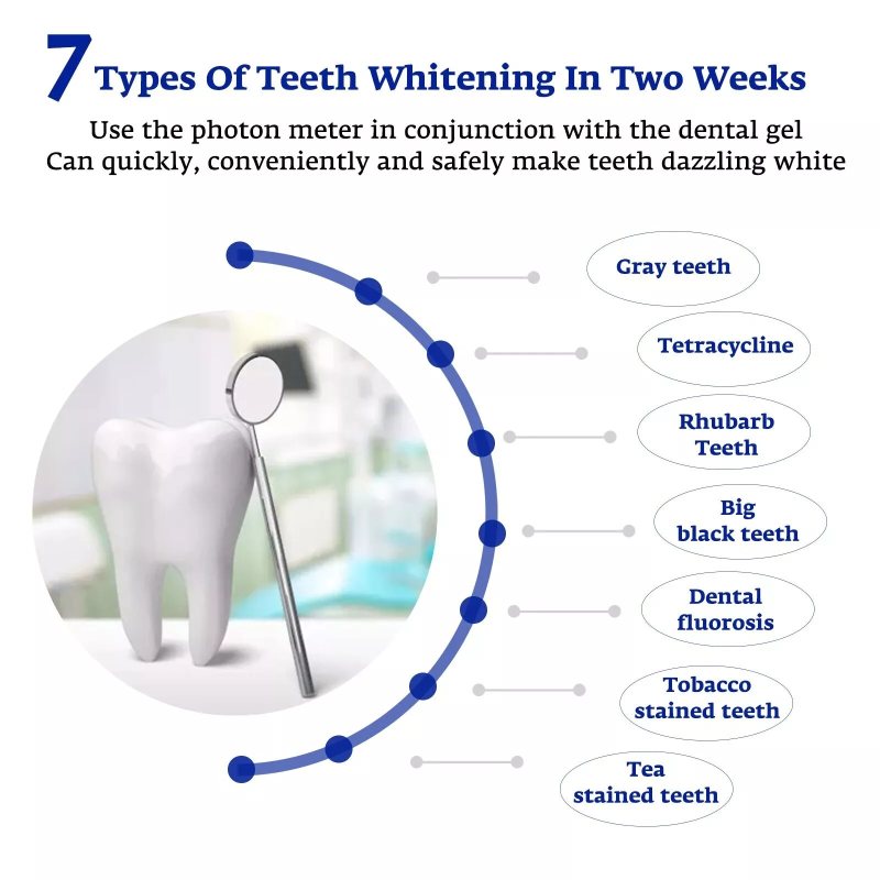 Teeth Whitening Accelerator Sm - огляд і ціна Teeth Whitening Led Kit