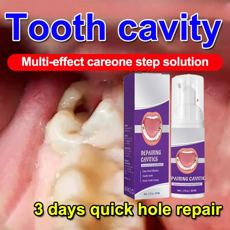 Teeth Cleaning Toothpaste Remo - огляд і ціна Teeth Whitening Toothpaste