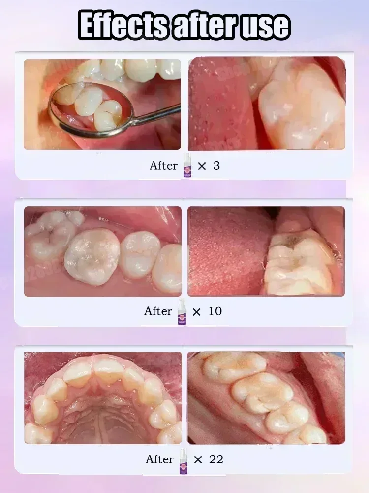 Teeth Cleaning Toothpaste Remo - огляд і ціна Teeth Whitening Toothpaste