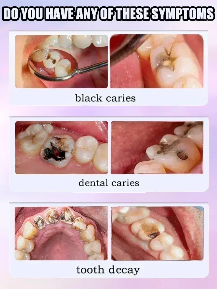 Teeth Cleaning Toothpaste Remo - огляд і ціна Teeth Whitening Toothpaste